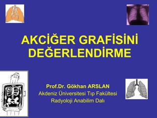 AKCİĞER GRAFİSİNİ DEĞERLENDİRME Prof.Dr. Gökhan ARSLAN Akdeniz Üniversitesi Tıp Fakültesi Radyoloji Anabilim Dalı 