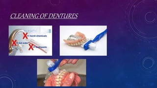 CLEANING OF DENTURES
 