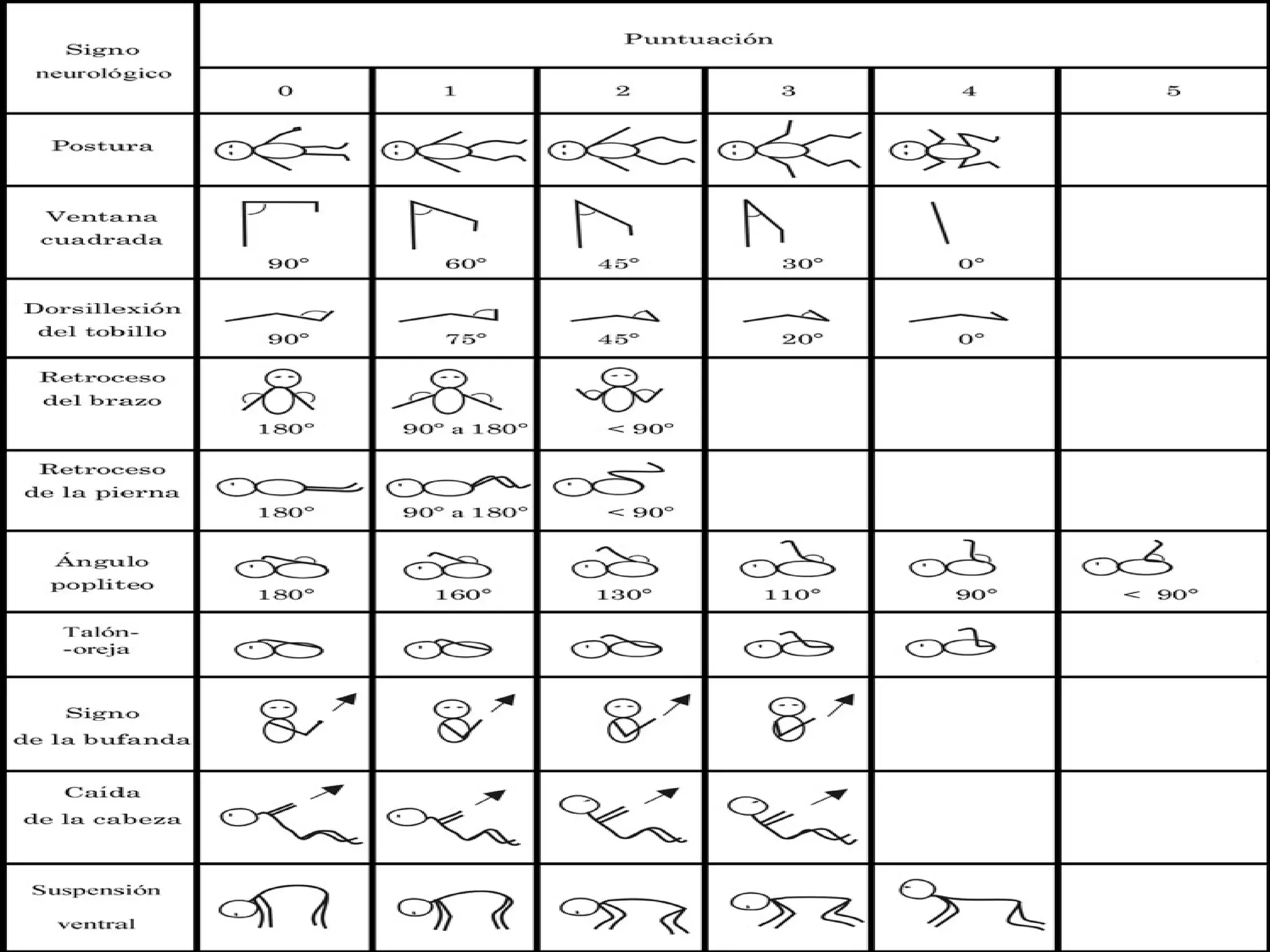 Tabla de dubowitz | PPT