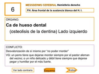 6
ÓRGANO:
Ca de hueso dental
(osteolisis de la dentina) Lado izquierdo
CONFLICTO:
Desvalorización de sí mismo por “no pode...