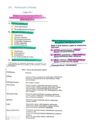 XIII. Perforación y Fístulas
 