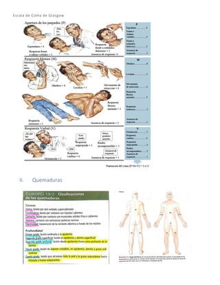 Escala de Coma de Glasgow
II. Quemaduras
 