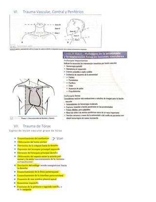 VI. Trauma Vascular, Central y Periférico
VII. Trauma de Tórax
Signos de lesión vascular grave de tórax
 