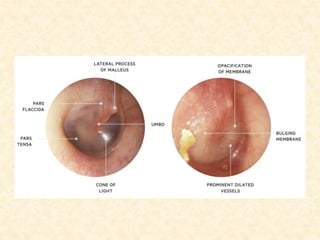CLINICAL ASPECTS related to Ear anatomy.pptx