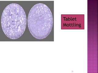 Tablet
Mottling
71
 