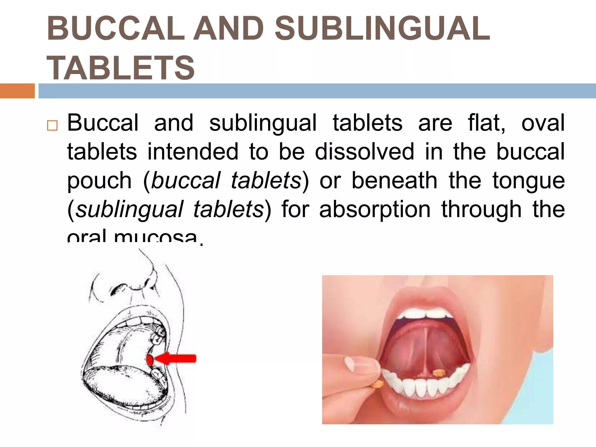Sublingually Tablets - Pharmaceutics | PPTX