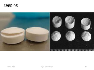 12-07-2016 Sagar Kishor Savale 86
Capping
 