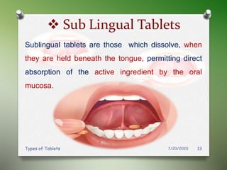 Sublingually Tablets (Types of tablets) | PPTX