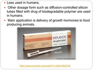  Less used in humans.
 Other dosage form such as diffusion-controlled silicon
tubes filled with drug of biodegradable polymer are used
in humans.
 Main application is delivery of growth hormones to food
producing animals.
https://www.youtube.com/watch?v=dn0I-HSgFQA
 