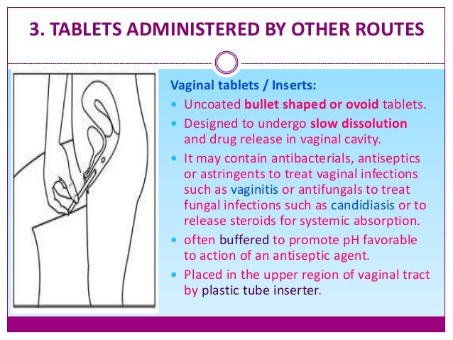 Tablet types and Excipients