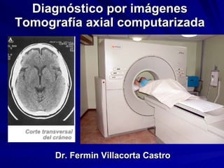 Diagnóstico por imágenes Tomografía axial computarizada Dr. Fermin Villacorta Castro 
