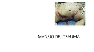 MANEJO DEL TRAUMA
 