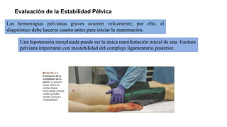Las hemorragias pelvianas graves ocurren velozmente; por ello, el
diagnóstico debe hacerse cuanto antes para iniciar la reanimación.
Evaluación de la Estabilidad Pélvica
Una hipotensión inexplicada puede ser la única manifestación inicial de una fractura
pelviana importante con inestabilidad del complejo ligamentario posterior.
 