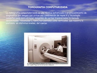 TOMOGRAFIA COMPUTARIZADA La tomografía computadorizada es una técnica sofisticada o un procedimiento de diagnostico por imagen que utiliza una combinación de rayos X y tecnología computarizada para obtener imágenes de cortes transversales (a menudo denominadas "rebanadas"), tanto horizontales como verticales, que nuestra la anatomía  en distintos niveles, del cuerpo. 