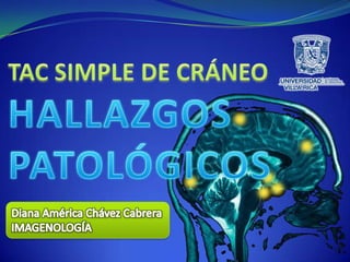 TAC SIMPLE DE CRÁNEOHALLAZGOS PATOLÓGICOS Diana América Chávez Cabrera IMAGENOLOGÍA 