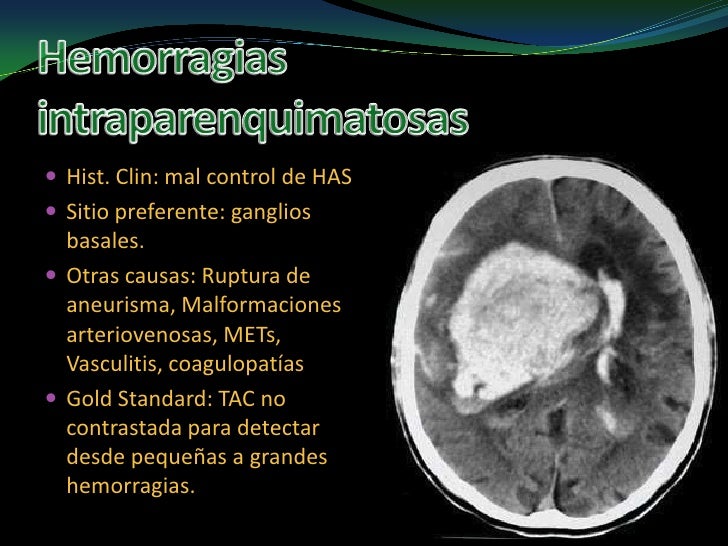 Como Interpretar Una Tac De Craneo