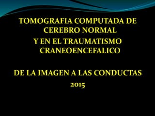 TOMOGRAFIA COMPUTADA DE
CEREBRO NORMAL
Y EN EL TRAUMATISMO
CRANEOENCEFALICO
DE LA IMAGEN A LAS CONDUCTAS
2015
 