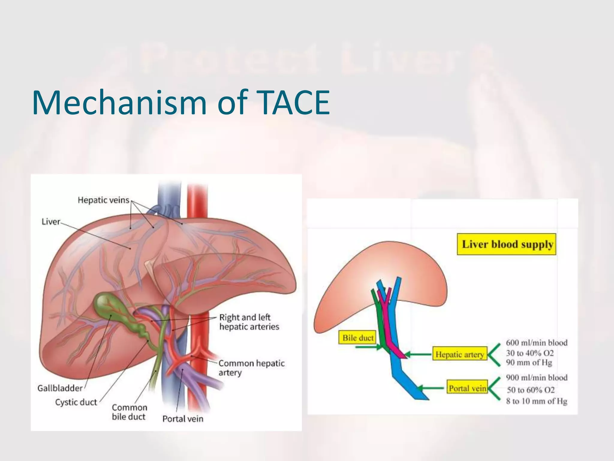 Mechanism of TACE
 