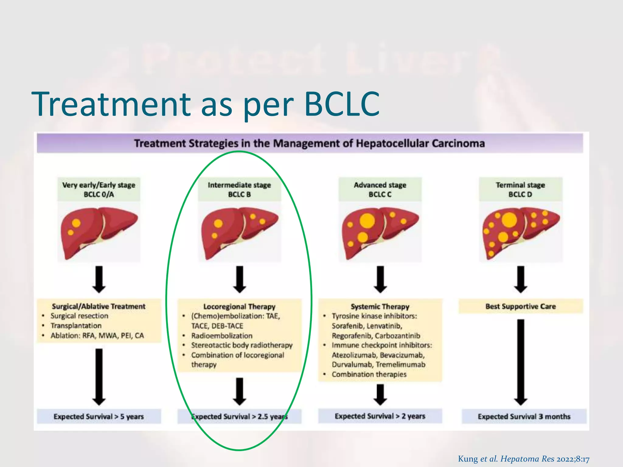 Treatment as per BCLC
Kung et al. Hepatoma Res 2022;8:17
 