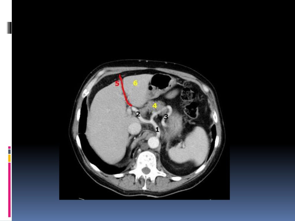 Tac higado pancreas y vesicula biliar Tac higado pancreas y vesicula biliar