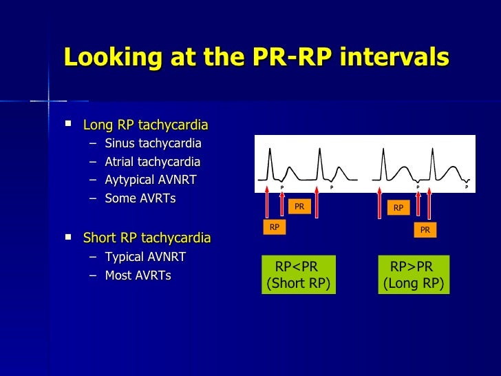 tachyarrhythmia