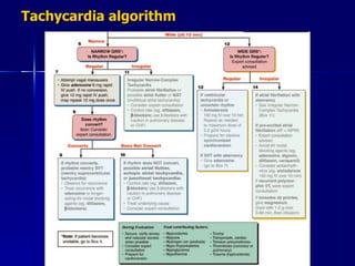 Tachycardia algorithm 