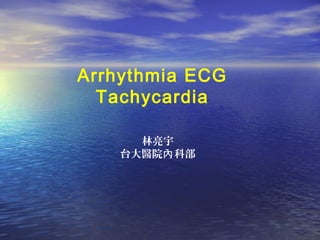 Arrhythmia ECG
Tachycardia
林亮宇
台大醫院 科部內
 