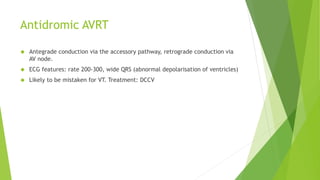 Antidromic AVRT 
 Antegrade conduction via the accessory pathway, retrograde conduction via 
AV node. 
 ECG features: rate 200-300, wide QRS (abnormal depolarisation of ventricles) 
 Likely to be mistaken for VT. Treatment: DCCV 
 