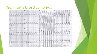 Technically broad complex… 
 