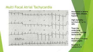 Multi Focal Atrial Tachycardia 
Associated w severe 
respiratory disease, 
hypoxia 
High mortality – 
survival at 1 yr is 
20% 
Treat the 
underlying 
condition, not the 
tachycardia 
Must have 3 P wave 
morphologies 
Baseline is 
isoelectric!!! 
 