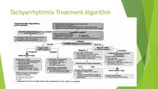 Tachyarrhythmia Treatment Algorithm 
 