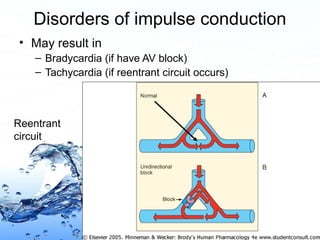 Page 88
Disorders of impulse conduction
• May result in
– Bradycardia (if have AV block)
– Tachycardia (if reentrant circuit occurs)
Reentrant
circuit
 