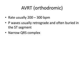 AVRT (orthodromic)
• Rate usually 200 – 300 bpm
• P waves usually retrograde and often buried in
the ST segment
• Narrow QRS complex
 