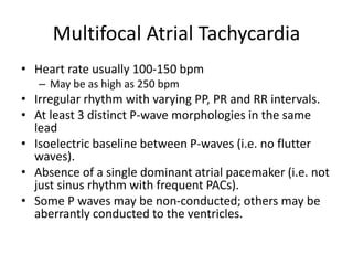 Multifocal Atrial Tachycardia
• Heart rate usually 100-150 bpm
– May be as high as 250 bpm
• Irregular rhythm with varying PP, PR and RR intervals.
• At least 3 distinct P-wave morphologies in the same
lead
• Isoelectric baseline between P-waves (i.e. no flutter
waves).
• Absence of a single dominant atrial pacemaker (i.e. not
just sinus rhythm with frequent PACs).
• Some P waves may be non-conducted; others may be
aberrantly conducted to the ventricles.
 
