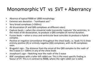 Monomorphic VT vs SVT + Aberrancy
• Absence of typical RBBB or LBBB morphology
• Extreme axis deviation - “northwest axis”
• Very broad complexes (>160ms)
• AV dissociation (P and QRS complexes at different rates)
• Capture beats —when the sinoatrial node transiently ‘captures’ the ventricles, in
the midst of AV dissociation, to produce a QRS complex of normal duration.
• Fusion beats —when a sinus and ventricular beat coincides to produce a hybrid
complex.
• Positive or negative concordance throughout the chest leads, i.e. leads V1-6 show
entirely positive (R) or entirely negative (QS) complexes, with no RS complexes
seen.
• Brugada’s sign - The distance from the onset of the QRS complex to the nadir of
the S-wave is > 100ms in any of the chest leads
• Josephson’s sign – Notching near the nadir of the S-wave
• RSR’ complexes with a taller left rabbit ear. This is the most specific finding in
favour of VT. This is in contrast to RBBB, where the right rabbit ear is taller.
 