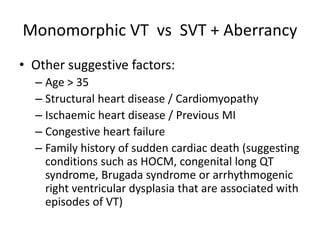 Monomorphic VT vs SVT + Aberrancy
• Other suggestive factors:
– Age > 35
– Structural heart disease / Cardiomyopathy
– Ischaemic heart disease / Previous MI
– Congestive heart failure
– Family history of sudden cardiac death (suggesting
conditions such as HOCM, congenital long QT
syndrome, Brugada syndrome or arrhythmogenic
right ventricular dysplasia that are associated with
episodes of VT)
 