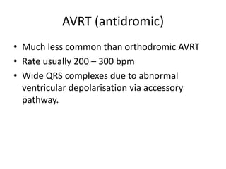 AVRT (antidromic)
• Much less common than orthodromic AVRT
• Rate usually 200 – 300 bpm
• Wide QRS complexes due to abnormal
ventricular depolarisation via accessory
pathway.
 