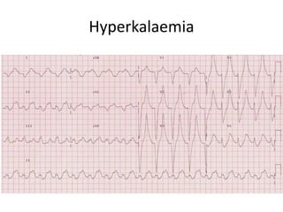 Hyperkalaemia
 