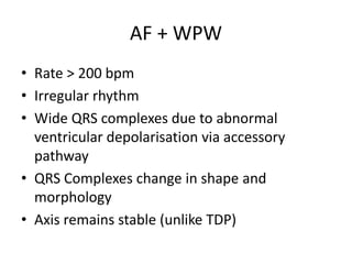 AF + WPW
• Rate > 200 bpm
• Irregular rhythm
• Wide QRS complexes due to abnormal
ventricular depolarisation via accessory
pathway
• QRS Complexes change in shape and
morphology
• Axis remains stable (unlike TDP)
 