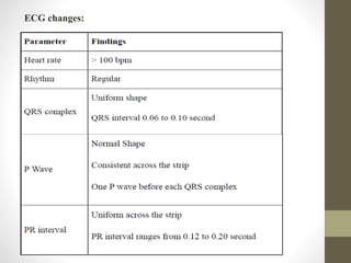 ECG changes:
 
