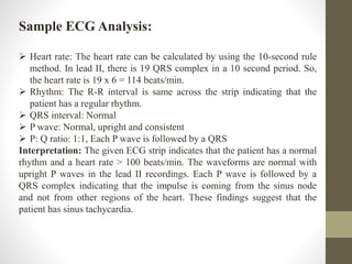 Sample ECG Analysis:
 Heart rate: The heart rate can be calculated by using the 10-second rule
method. In lead II, there is 19 QRS complex in a 10 second period. So,
the heart rate is 19 x 6 = 114 beats/min.
 Rhythm: The R-R interval is same across the strip indicating that the
patient has a regular rhythm.
 QRS interval: Normal
 P wave: Normal, upright and consistent
 P: Q ratio: 1:1, Each P wave is followed by a QRS
Interpretation: The given ECG strip indicates that the patient has a normal
rhythm and a heart rate > 100 beats/min. The waveforms are normal with
upright P waves in the lead II recordings. Each P wave is followed by a
QRS complex indicating that the impulse is coming from the sinus node
and not from other regions of the heart. These findings suggest that the
patient has sinus tachycardia.
 