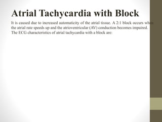 Atrial Tachycardia with Block
It is caused due to increased automaticity of the atrial tissue. A 2:1 block occurs when
the atrial rate speeds up and the atrioventricular (AV) conduction becomes impaired.
The ECG characteristics of atrial tachycardia with a block are:
 