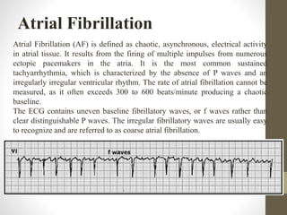 Atrial Fibrillation
Atrial Fibrillation (AF) is defined as chaotic, asynchronous, electrical activity
in atrial tissue. It results from the firing of multiple impulses from numerous
ectopic pacemakers in the atria. It is the most common sustained
tachyarrhythmia, which is characterized by the absence of P waves and an
irregularly irregular ventricular rhythm. The rate of atrial fibrillation cannot be
measured, as it often exceeds 300 to 600 beats/minute producing a chaotic
baseline.
The ECG contains uneven baseline fibrillatory waves, or f waves rather than
clear distinguishable P waves. The irregular fibrillatory waves are usually easy
to recognize and are referred to as coarse atrial fibrillation.
 