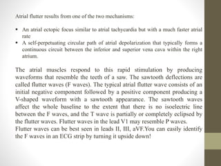 Atrial flutter results from one of the two mechanisms:
 An atrial ectopic focus similar to atrial tachycardia but with a much faster atrial
rate
 A self-perpetuating circular path of atrial depolarization that typically forms a
continuous circuit between the inferior and superior vena cava within the right
atrium.
The atrial muscles respond to this rapid stimulation by producing
waveforms that resemble the teeth of a saw. The sawtooth deflections are
called flutter waves (F waves). The typical atrial flutter wave consists of an
initial negative component followed by a positive component producing a
V-shaped waveform with a sawtooth appearance. The sawtooth waves
affect the whole baseline to the extent that there is no isoelectric line
between the F waves, and the T wave is partially or completely eclipsed by
the flutter waves. Flutter waves in the lead V1 may resemble P waves.
Flutter waves can be best seen in leads II, III, aVF.You can easily identify
the F waves in an ECG strip by turning it upside down!
 