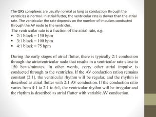 The QRS complexes are usually normal as long as conduction through the
ventricles is normal. In atrial flutter, the ventricular rate is slower than the atrial
rate. The ventricular the rate depends on the number of impulses conducted
through the AV node to the ventricles.
The ventricular rate is a fraction of the atrial rate, e.g.
 2:1 block = 150 bpm
 3:1 block = 100 bpm
 4:1 block = 75 bpm
During the early stages of atrial flutter, there is typically 2:1 conduction
through the atrioventricular node that results in a ventricular rate close to
150 beats/minutes. In other words, every other atrial impulse is
conducted through to the ventricles. If the AV conduction ration remains
constant (2:1), the ventricular rhythm will be regular, and the rhythm is
described as atrial flutter with 2:1 AV conduction. If the conduction ratio
varies from 4:1 to 2:1 to 6:1, the ventricular rhythm will be irregular and
the rhythm is described as atrial flutter with variable AV conduction.
 