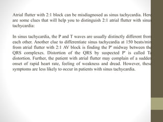 Atrial flutter with 2:1 block can be misdiagnosed as sinus tachycardia. Here
are some clues that will help you to distinguish 2:1 atrial flutter with sinus
tachycardia:
In sinus tachycardia, the P and T waves are usually distinctly different from
each other. Another clue to differentiate sinus tachycardia at 150 beats/min
from atrial flutter with 2:1 AV block is finding the P' midway between the
QRS complexes. Distortion of the QRS by suspected P' is called Ta
distortion. Further, the patient with atrial flutter may complain of a sudden
onset of rapid heart rate, feeling of weakness and dread. However, these
symptoms are less likely to occur in patients with sinus tachycardia.
 