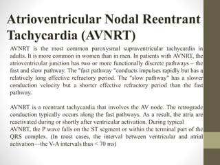 Atrioventricular Nodal Reentrant
Tachycardia (AVNRT)
AVNRT is the most common paroxysmal supraventricular tachycardia in
adults. It is more common in women than in men. In patients with AVNRT, the
atrioventricular junction has two or more functionally discrete pathways – the
fast and slow pathway. The "fast pathway "conducts impulses rapidly but has a
relatively long effective refractory period. The "slow pathway" has a slower
conduction velocity but a shorter effective refractory period than the fast
pathway.
AVNRT is a reentrant tachycardia that involves the AV node. The retrograde
conduction typically occurs along the fast pathways. As a result, the atria are
reactivated during or shortly after ventricular activation. During typical
AVNRT, the P wave falls on the ST segment or within the terminal part of the
QRS complex. (In most cases, the interval between ventricular and atrial
activation—the V-A intervals thus < 70 ms)
 