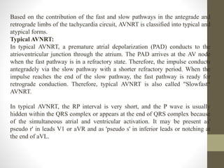 Based on the contribution of the fast and slow pathways in the antegrade and
retrograde limbs of the tachycardia circuit, AVNRT is classified into typical and
atypical forms.
Typical AVNRT:
In typical AVNRT, a premature atrial depolarization (PAD) conducts to the
atrioventricular junction through the atrium. The PAD arrives at the AV node
when the fast pathway is in a refractory state. Therefore, the impulse conducts
antegradely via the slow pathway with a shorter refractory period. When the
impulse reaches the end of the slow pathway, the fast pathway is ready for
retrograde conduction. Therefore, typical AVNRT is also called "Slowfast“
AVNRT.
In typical AVNRT, the RP interval is very short, and the P wave is usually
hidden within the QRS complex or appears at the end of QRS complex because
of the simultaneous atrial and ventricular activation. It may be present as'
pseudo r' in leads V1 or aVR and as 'pseudo s' in inferior leads or notching at
the end of aVL.
 