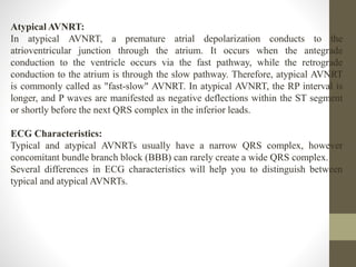 Atypical AVNRT:
In atypical AVNRT, a premature atrial depolarization conducts to the
atrioventricular junction through the atrium. It occurs when the antegrade
conduction to the ventricle occurs via the fast pathway, while the retrograde
conduction to the atrium is through the slow pathway. Therefore, atypical AVNRT
is commonly called as "fast-slow" AVNRT. In atypical AVNRT, the RP interval is
longer, and P waves are manifested as negative deflections within the ST segment
or shortly before the next QRS complex in the inferior leads.
ECG Characteristics:
Typical and atypical AVNRTs usually have a narrow QRS complex, however
concomitant bundle branch block (BBB) can rarely create a wide QRS complex.
Several differences in ECG characteristics will help you to distinguish between
typical and atypical AVNRTs.
 