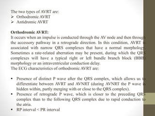 The two types of AVRT are:
 Orthodromic AVRT
 Antidromic AVRT
Orthodromic AVRT:
It occurs when an impulse is conducted through the AV node and then through
the accessory pathway in a retrograde direction. In this condition, AVRT is
associated with narrow QRS complexes that have a normal morphology.
Sometimes a rate-related aberration may be present, during which the QRS
complexes will have a typical right or left bundle branch block (BBB)
morphology or an intraventricular conduction delay.
The ECG characteristics of orthodromic AVRT are:
 Presence of distinct P wave after the QRS complex, which allows us to
differentiate between AVRT and AVNRT (during AVNRT the P wave is
hidden within, partly merging with or close to the QRS complex).
 Presence of retrograde P wave, which is closer to the preceding QRS
complex than to the following QRS complex due to rapid conduction to
the atria.
 RP interval < PR interval
 
